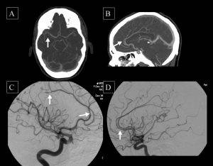 cta-dr-taghavi-shahrokh-articles
