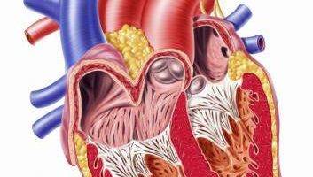 Heart disease definition