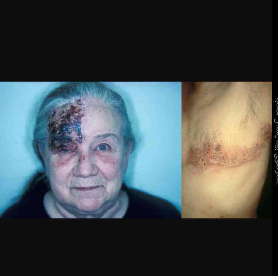 زونا-سایت-دکتر-سید-شاهرخ-تقوی-فوق-تخصص-قلب-و-عروق-فلوشیپ-آنژیوپلاستی