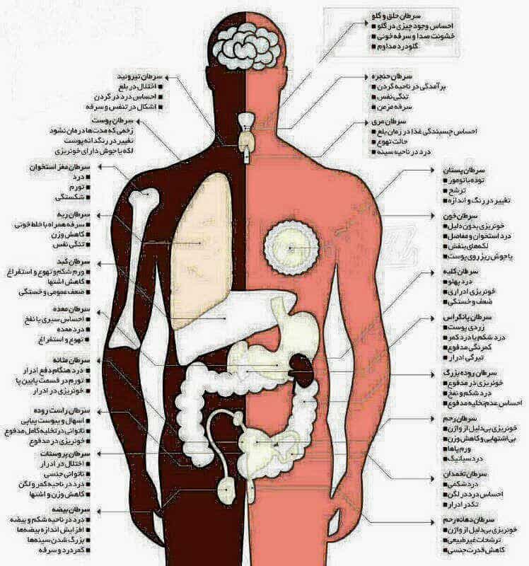 علائم سرطان در ارگان‌های مختلف بدن