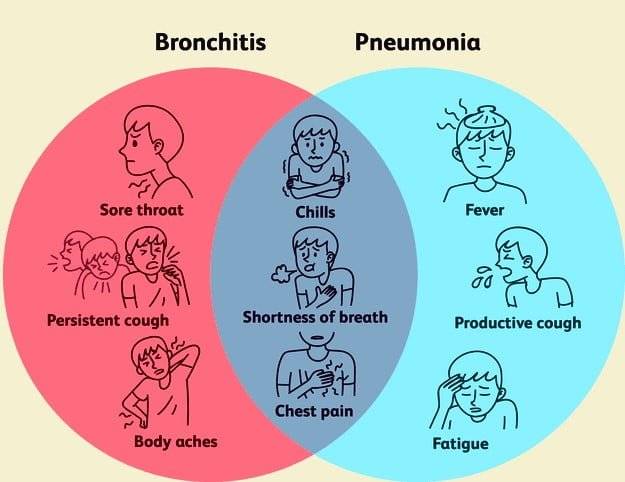 پنومونی (Pneumonia)