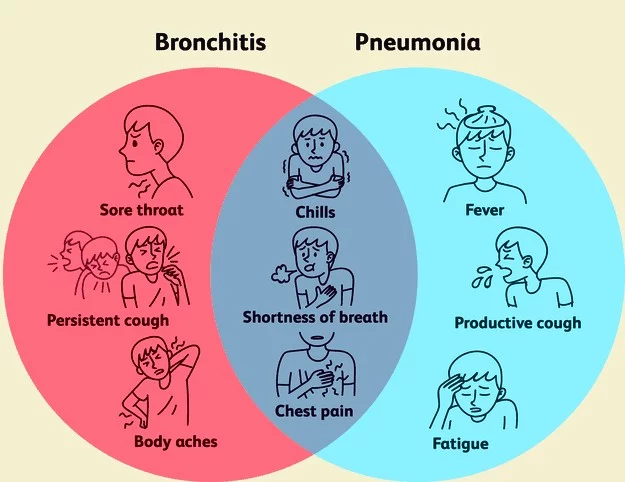 پنومونی (Pneumonia)
