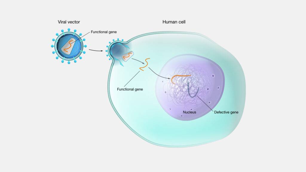 5 پیشرفت در زمینه تشخیص و درمان بیماری های قلبی-5 advancements in the field of heart disease detection and treatment